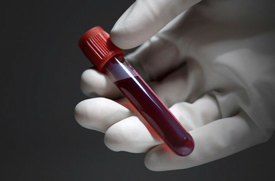تولید و تزریق خون آزمایشگاهی